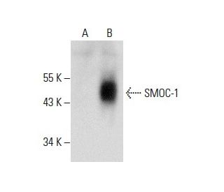 SMOC-1 Antibody (A-10) - Western Blotting - Image 288588 
