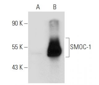 SMOC-1 Antibody (F-3) - Western Blotting - Image 45288