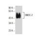 SMOC-2 Antibody (F-11) - Western Blotting - Image 153967