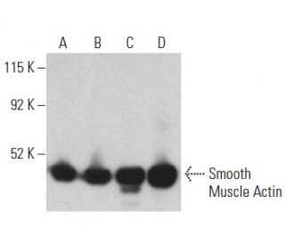 Smooth Muscle Actin Antibody (CGA7) - Western Blotting - Image 398872 