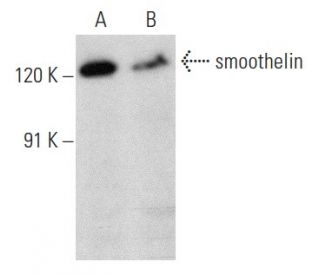 smoothelin Antibody (B-1) - Western Blotting - Image 358464 