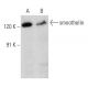 smoothelin Antibody (B-1) - Western Blotting - Image 358464 