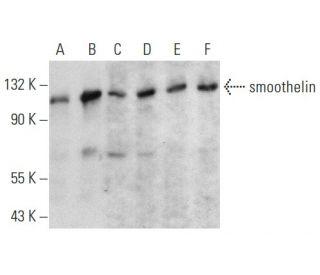 smoothelin Antibody (D-10) - Western Blotting - Image 358458 