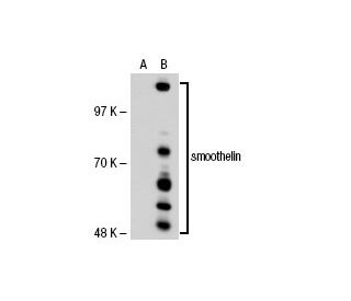 smoothelin Antibody (2Q1120) - Western Blotting - Image 30235 