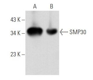 SMP30 Antibody (17) - Western Blotting - Image 356824 