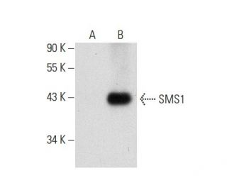 SMS1 Antibody (F-10) - Western Blotting - Image 72958 