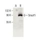 Smurf1 Antibody (C-11) - Western Blotting - Image 396354