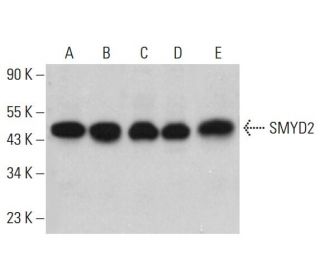 SMYD2 Antibody (F-9) - Western Blotting - Image 381736