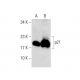 SN 38: sc-203697. Western blot analysis of p21 expression in untreated (A) and SN 38 treated (B) HCT 116 whole cell lysate 