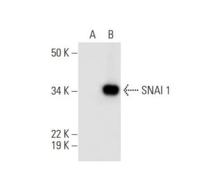 SNAI 1 Antibody (E-10) - Western Blotting - Image 292936