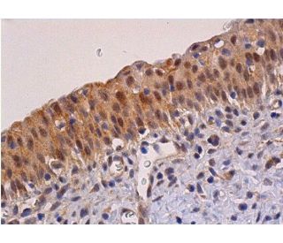 SNAI 1 Antibody (G-7) - Immunohistochemistry - Image 354987 
