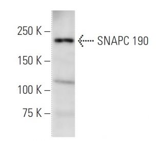 SNAPC 190 Antibody (SNAAD17A) - Western Blotting - Image 16772 