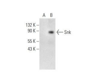Snk Antibody (A-6) - Western Blotting - Image 289977Each CRISPR/Cas9 Knockout (KO) Plasmid product consists of a pool of 3 plasmids designed to ensure identification and cleavage of a specific gene for maximum knockout efficiency. Each plasmid encodes a unique 20 nt sequence derived from the GeCKO (v2) library.