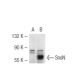 SnoN Antibody (C6) - Western Blotting - Image 45292 