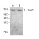 SnoN Antibody (C6) - Western Blotting - Image 380351