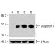 Snurportin-1 抗体 (C-1):sc-390155。Western blot 分析未处理的完整 K-562 细胞裂解物 (A)、经化学处理的 K-562 细胞裂解物 (B)、HCT-116 细胞裂解物 (C) 和 HeLa 细胞裂解物 (D) 中 Snurportin-1 的表达。使用的检测试剂:m-IgG1 BP-HRP:sc-525408。β-肌动蛋白(C4):sc-47778,用作加载对照。使用的检测试剂:m-IgG Fc BP-HRP:sc-525409。  Snurportin-1 Antibody (C-1) - Western Blotting - Image 415018