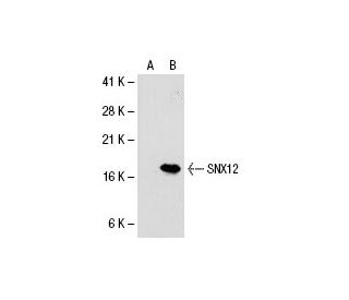 SNX12 Antibody (42-Y) - Western Blotting - Image 20974 