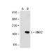 SNX12 Antibody (42-Y) - Western Blotting - Image 20974 