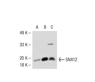 SNX12 Antibody (42-Y) - Western Blotting - Image 54074