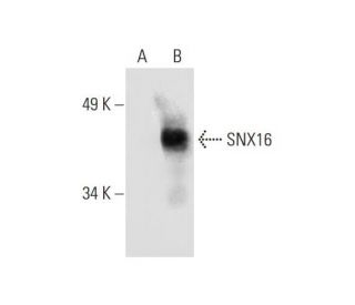 SNX16 Antibody (C-11) - Western Blotting - Image 289483 
