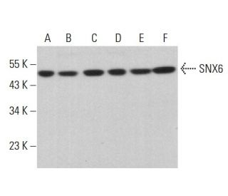 SNX6 Antibody (D-1) - Western Blotting - Image 381869 