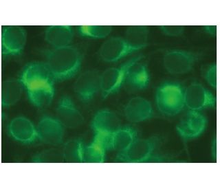 SOAT1 Antibody (A-11) - Immunofluorescence - Image 114098 