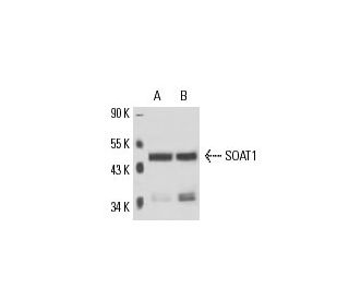 SOAT1 Antibody (ACAT-1) - Western Blotting - Image 15851 