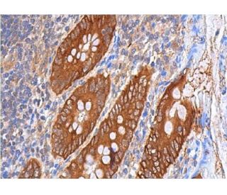 Superoxide Dismutase 2/SOD2 Antibody (E-7) - Immunohistochemistry - Image 355387 