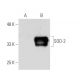 Superoxide Dismutase 3/SOD3 Antibody (1H12) - Western Blotting - Image 62865