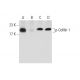 Sodium metavanadate: sc-251034. Western blot analysis of Cofilin 1 phosphorylation in K-562 (A), lambda phosphatase (sc-20