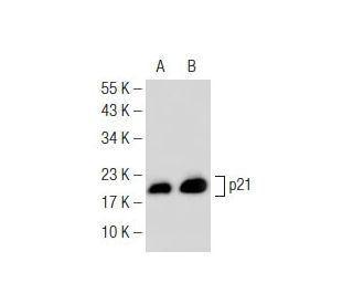 Sodium Phenylbutyrate: sc-200652. Western blot analysis of p21 expression in untreated (A) and Sodium Phenylbutyrate treat 