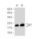 Sodium Phenylbutyrate: sc-200652. Western blot analysis of p21 expression in untreated (A) and Sodium Phenylbutyrate treat 