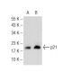 Sodium Phenylbutyrate: sc-200652. Western blot analysis of p21 expression in untreated (A) and Sodium Phenylbutyrate treat