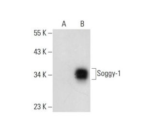 Soggy-1 Antibody (D-10) - Western Blotting - Image 297135