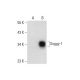 Soggy-1 Antibody (D-10) - Western Blotting - Image 297135