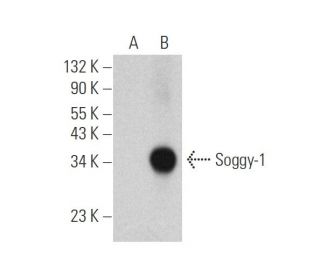 Soggy-1 Antibody (H-11) - Western Blotting - Image 346517