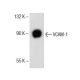 VCAM-1 Antibody (M/K-2) - Western Blotting - Image 153709