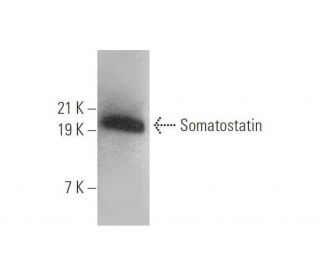 Somatostatin Antibody (G-10) - Western Blotting - Image 352420 