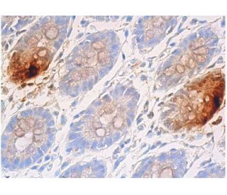 Somatostatin Antibody (YC7) - Immunohistochemistry - Image 357908 
