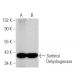 Sorbitol Dehydrogenase Antibody (E-8) - Western Blotting - Image 369316 