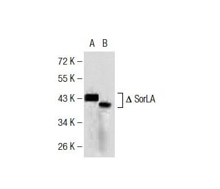 SorLA Antibody (7D7B11) - Western Blotting - Image 137457