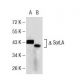 SorLA Antibody (7D7B11) - Western Blotting - Image 137457