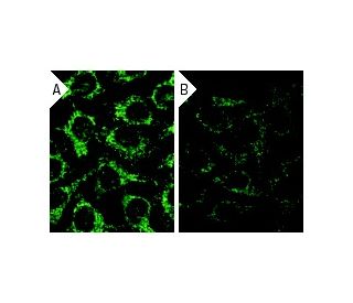 Sos 1 siRNA (h): sc-29486. Immunofluorescence staining of methanol-fixed, control HeLa (A) and Sos 1 siRNA silenced HeLa ( 