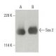 Sos 2 Antibody (B-6) - Western Blotting - Image 396668