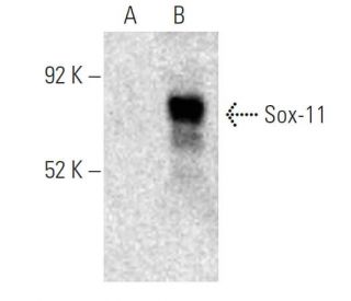 Sox-11 Antibody (B-11) - Western Blotting - Image 395945 