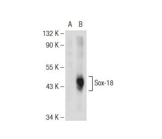 Sox-18 Antibody (E-2) - Western Blotting - Image 108810