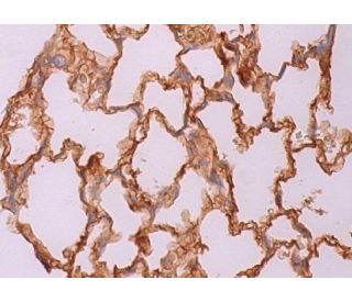 SP-B Antibody (F-2) - Immunohistochemistry - Image 370273 