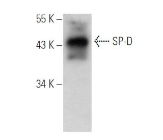 SP-D Antibody (10H11) - Western Blotting - Image 11602