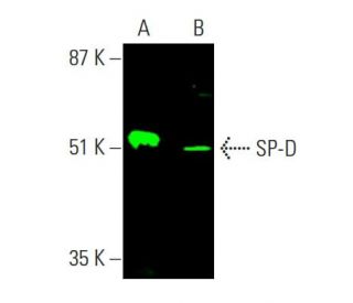 SP-D Antibody (C-6) - Western Blotting - Image 386216Each CRISPR/Cas9 Knockout (KO) Plasmid product consists of a pool of 3 plasmids designed to ensure identification and cleavage of a specific gene for maximum knockout efficiency. Each plasmid encodes a unique 20 nt sequence derived from the GeCKO (v2) library.