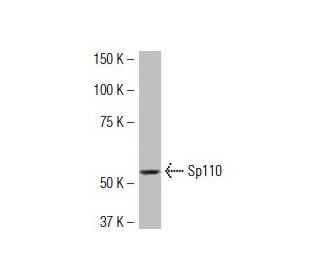 Sp110 Antibody (JR-16) - Western Blotting - Image 34143 